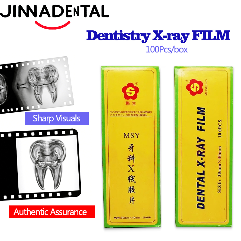 X Medical Lab - ฟิล์มเอ็กซ์เรย์ทันตกรรมขนาด 30*40 มม. ฟิล์มภาพทางการแพทย์สำหรับช่องปาก ฟิล์มเอ็กซ์เรย์ดิจิตอล MSY