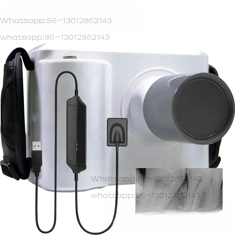 เครื่องเอกซเรย์ทันตกรรมแบบพกพา - Veterinary X-Ray บทวิจารณ์และราคา