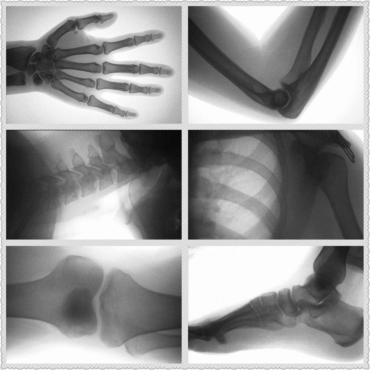 เครื่องเอกซเรย์ทางการแพทย์แบบพ - Veterinary X-Ray บทวิจารณ์และราคา
